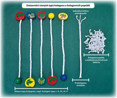 FOTKA - Vte, jak sprvn vybrat kloubn vivu?