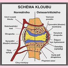 kloubn viva